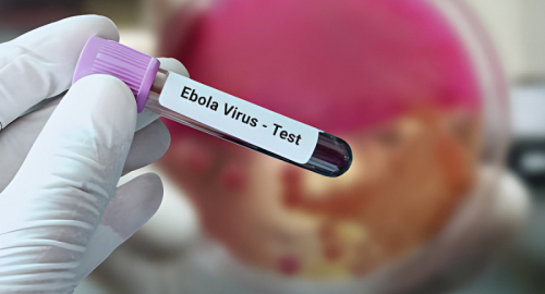 Ebola, l'Uganda si dichiara libera dal virus dopo 42 giorni senza contagi
